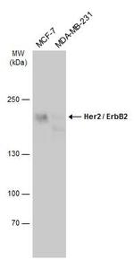 ErbB2 (HER-2) Antibody in Western Blot (WB)