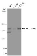 ErbB2 (HER-2) Antibody in Western Blot (WB)