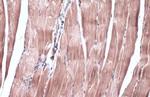 IRS2 Antibody in Immunohistochemistry (Paraffin) (IHC (P))