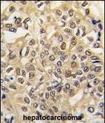 UBE1 Antibody in Immunohistochemistry (Paraffin) (IHC (P))