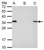 S-peptide Epitope Tag Antibody in Immunoprecipitation (IP)