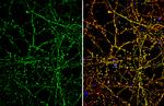 SLC1A7 Antibody in Immunocytochemistry (ICC/IF)