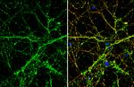 SLIT1 Antibody in Immunocytochemistry (ICC/IF)