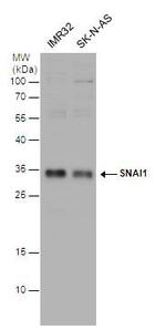 SNAIL Antibody in Western Blot (WB)