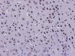 HMGB1 Antibody in Immunohistochemistry (Paraffin) (IHC (P))