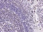 HMGB1 Antibody in Immunohistochemistry (Paraffin) (IHC (P))