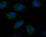 SNAIL Antibody in Immunocytochemistry (ICC/IF)