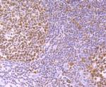 SNAIL Antibody in Immunohistochemistry (Paraffin) (IHC (P))