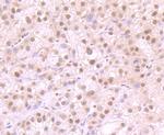 SNAIL Antibody in Immunohistochemistry (Paraffin) (IHC (P))