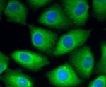 ROBO1 Antibody in Immunocytochemistry (ICC/IF)