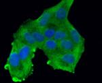 ROBO1 Antibody in Immunocytochemistry (ICC/IF)