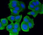 ROBO1 Antibody in Immunocytochemistry (ICC/IF)