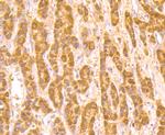 ROBO1 Antibody in Immunohistochemistry (Paraffin) (IHC (P))