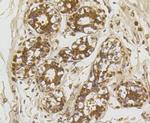 ROBO1 Antibody in Immunohistochemistry (Paraffin) (IHC (P))