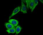 ROCK2 Antibody in Immunocytochemistry (ICC/IF)