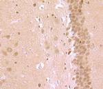 ROCK2 Antibody in Immunohistochemistry (Paraffin) (IHC (P))