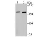 ROCK2 Antibody in Western Blot (WB)