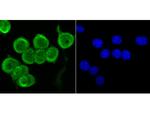 Fyn Antibody in Immunocytochemistry (ICC/IF)