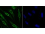 Fyn Antibody in Immunocytochemistry (ICC/IF)