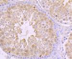 Fyn Antibody in Immunohistochemistry (Paraffin) (IHC (P))