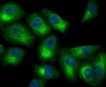 ATP Citrate Lyase Antibody in Immunocytochemistry (ICC/IF)