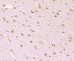 ATP Citrate Lyase Antibody in Immunohistochemistry (Paraffin) (IHC (P))