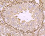 ATP Citrate Lyase Antibody in Immunohistochemistry (Paraffin) (IHC (P))