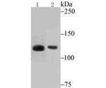 ATP Citrate Lyase Antibody in Western Blot (WB)