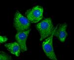 MMP3 Antibody in Immunocytochemistry (ICC/IF)