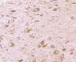 MMP3 Antibody in Immunohistochemistry (Paraffin) (IHC (P))