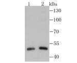 RARA Antibody in Western Blot (WB)