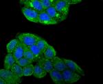 SMAD4 Antibody in Immunocytochemistry (ICC/IF)