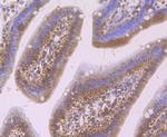 SMAD4 Antibody in Immunohistochemistry (Paraffin) (IHC (P))