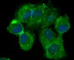 beta Arrestin 1 Antibody in Immunocytochemistry (ICC/IF)