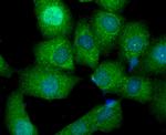 beta Arrestin 1 Antibody in Immunocytochemistry (ICC/IF)