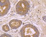 beta Arrestin 1 Antibody in Immunohistochemistry (Paraffin) (IHC (P))