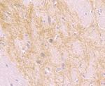 beta Arrestin 1 Antibody in Immunohistochemistry (Paraffin) (IHC (P))