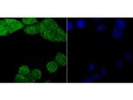 PKC beta Antibody in Immunocytochemistry (ICC/IF)