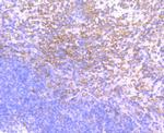 PKC beta Antibody in Immunohistochemistry (Paraffin) (IHC (P))