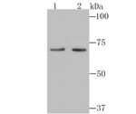 PKC beta Antibody in Western Blot (WB)