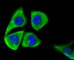 MFN2 Antibody in Immunocytochemistry (ICC/IF)