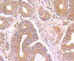 SFRP1 Antibody in Immunohistochemistry (Paraffin) (IHC (P))