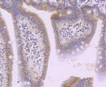 SFRP1 Antibody in Immunohistochemistry (Paraffin) (IHC (P))