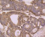 Annexin A3 Antibody in Immunohistochemistry (Paraffin) (IHC (P))