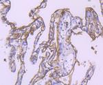 TROP2 Antibody in Immunohistochemistry (Paraffin) (IHC (P))