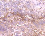 TROP2 Antibody in Immunohistochemistry (Paraffin) (IHC (P))