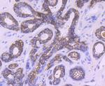 TROP2 Antibody in Immunohistochemistry (Paraffin) (IHC (P))