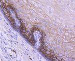 TROP2 Antibody in Immunohistochemistry (Paraffin) (IHC (P))