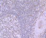 RUNX2 Antibody in Immunohistochemistry (Paraffin) (IHC (P))