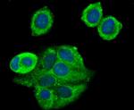 TAK1 Antibody in Immunocytochemistry (ICC/IF)